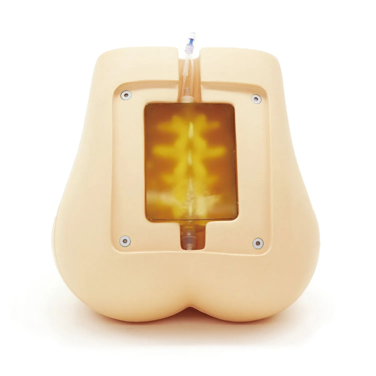 Ultrasound Lumbar Puncture Simulator